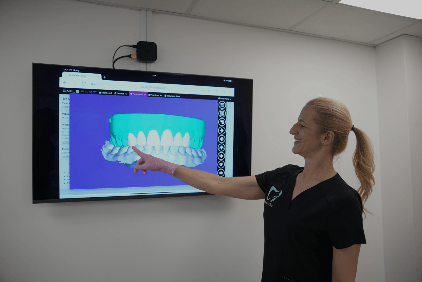 Who Full Arch Dental Implants May Suit at Kington Dental for patients from Builth Wells