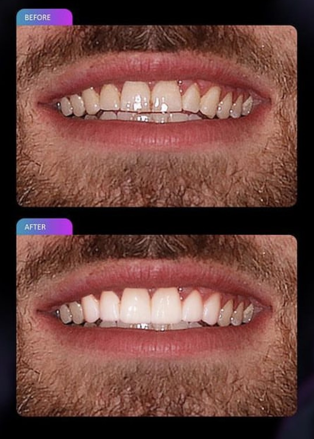 before and after dental treatment patient comparison